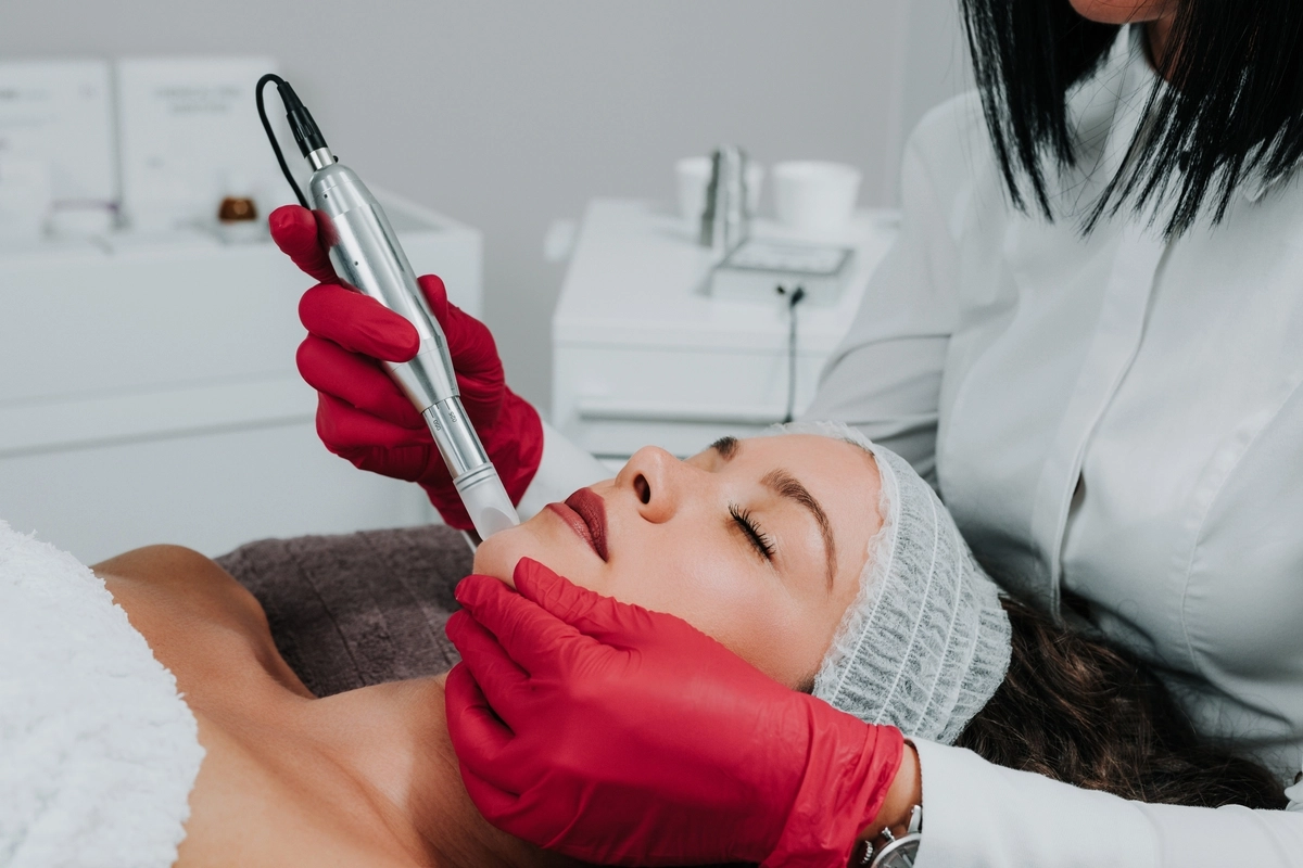 Exploring-the-Top-5-Benefits-of-Microneedling