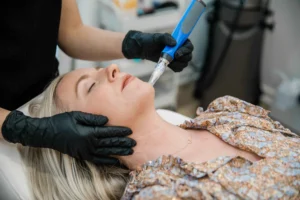 SkinPen® Elite Microneedling