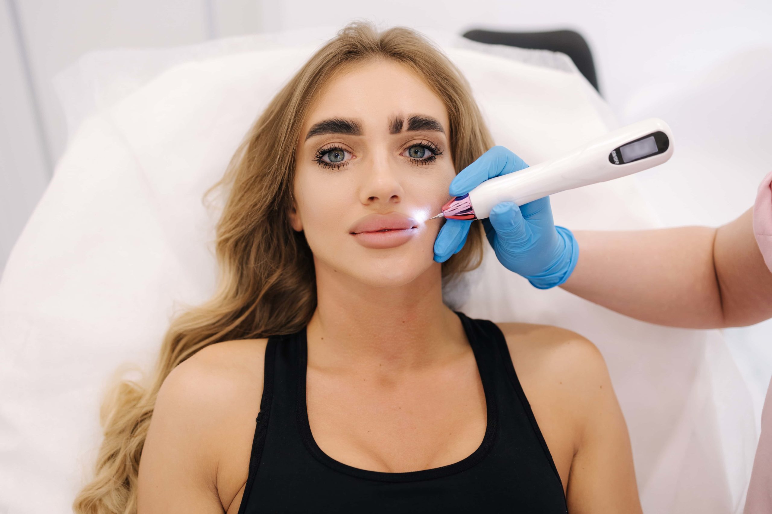 What Is Plasma Pen Treatment, And How Long Does It Take To See Results After
